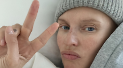 Bianca Balti lotta contro il tumore. Tutta la sua forza sul palco del Festival di Sanremo