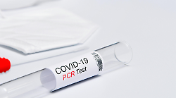 Covid, a che punto siamo? Contagi in aumento. Il virus è più debole, ma ci sono ancora ricoveri e decessi