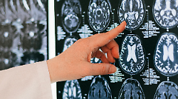 Morbo della mucca pazza, un caso ad Arezzo. La Asl: "Nessun allarme, non &egrave; trasmissibile da uomo a uomo"