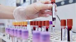 Subbiano, caso di influenza aviaria in un allevamento. Nessuna persona positiva