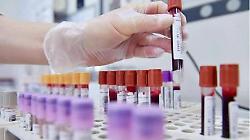 Caso di influenza aviaria in un allevamento. Nessuna persona positiva