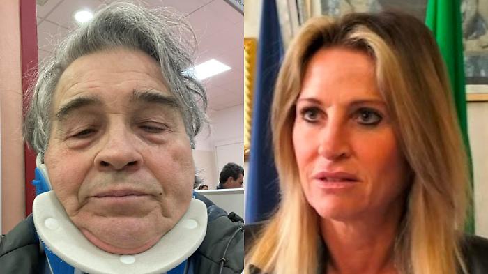 Pirata della strada scoperto e denunciato per omissione di soccorso: aveva tamponato e ferito Fabio Roggiolani