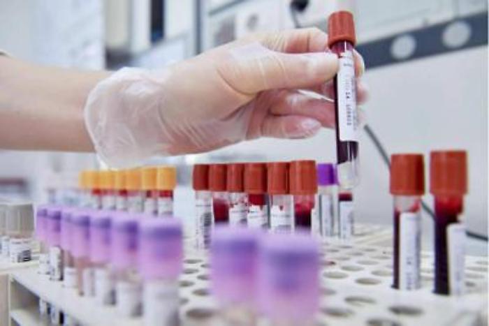 Subbiano, caso di influenza aviaria in un allevamento. Nessuna persona positiva